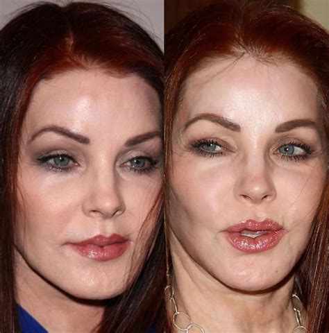 Priscilla Presley Plastic Surgery Nightmare