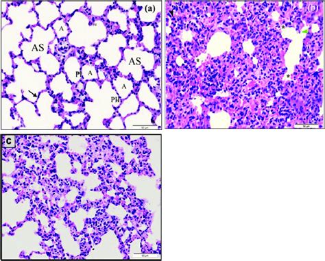 Image Result For Alveoli Histology Diagram Type I Image Diagram | My ...