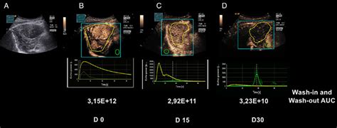 A-D, Longitudinal B-mode ultrasound (B-US), contrast enhanced... | Download Scientific Diagram