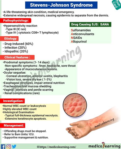 Medicolearning Steven Johnson Syndrome flash card | Steven johnson ...