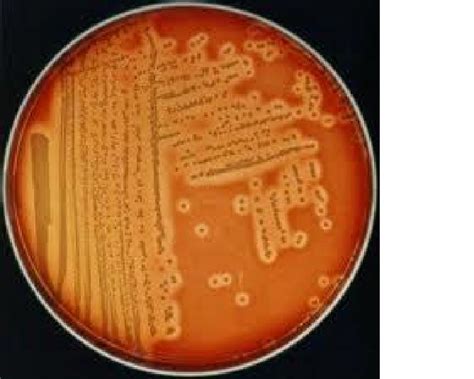 Beta-Lactamase activity | Download Scientific Diagram