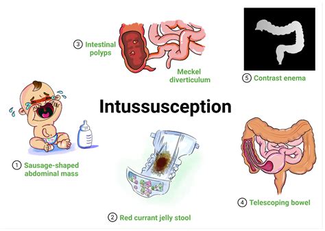 Abdominal Trauma Cartoons