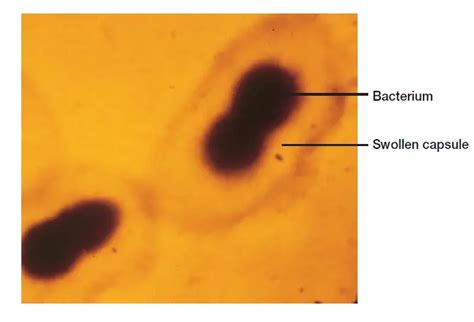 Serotypes and Their Significance • Microbe Online