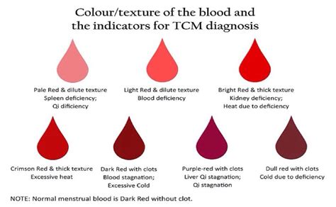 Why Do I Have So Much Blood Clots During Period at Marcia Rosales blog