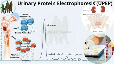 Understanding Urinary Protein Electrophoresis: Procedure ...