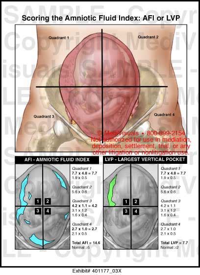 Normal amniotic fluid - jmtiklo