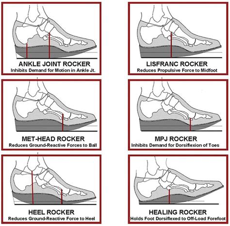 Rocker-bottom footwear: effects on balance, gait | Lower Extremity Review Magazine