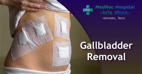 Gallbladder Removal Surgery : Everything You Need To Know