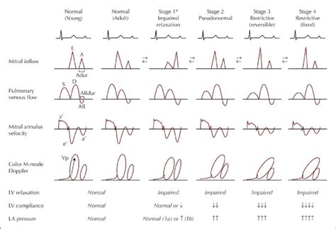 Normal Lv Systolic Function In Hindi | IQS Executive