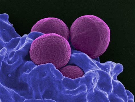 Narrow- and Broad Spectrum-Antibiotics