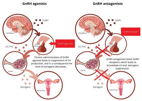 JCM | Free Full-Text | Gonadotropin-Releasing Hormone Antagonists—A New ...