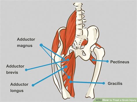 How to Treat a Groin Injury: Symptoms + Tips for Immediate Relief