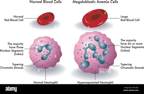 Neutrophil hi-res stock photography and images - Alamy