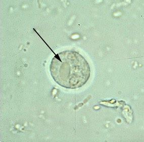 Cyst of E. histolytica | Medical Laboratories