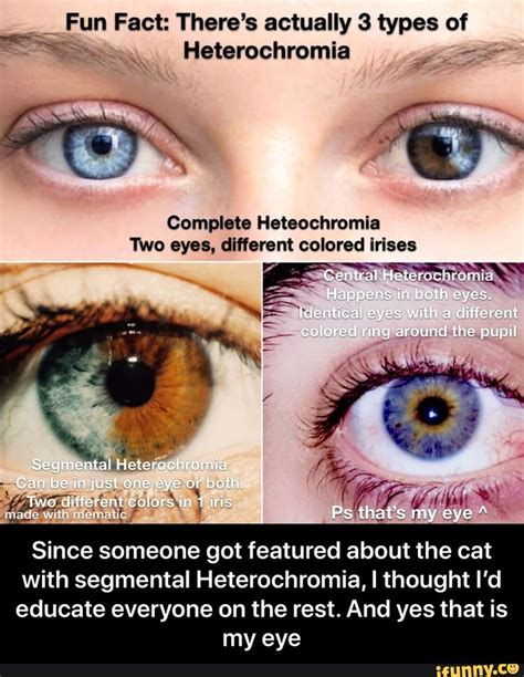 Fun Fact: There's actually types of Heterochromia Complete Heteochromia ...