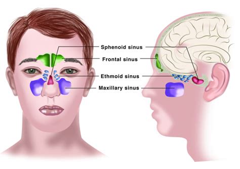 How To Detect Sinus - Effortbroad24