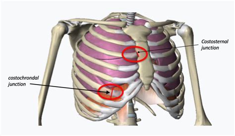 Complex Chest Wall Injury | Rib Injury Clinic