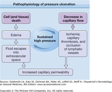 Decubitus (Pressure) Ulcers | Plastic Surgery Key