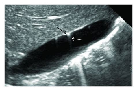 Ultrasound images at 4 months of age (a) and 7 months of age (b ...