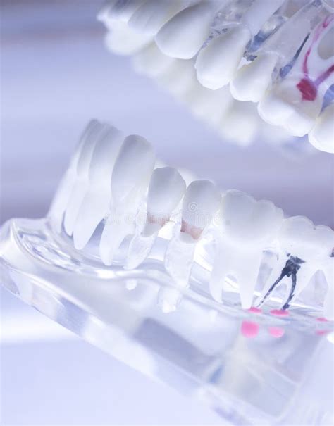 Dental teeth mouth model stock image. Image of human - 102585643