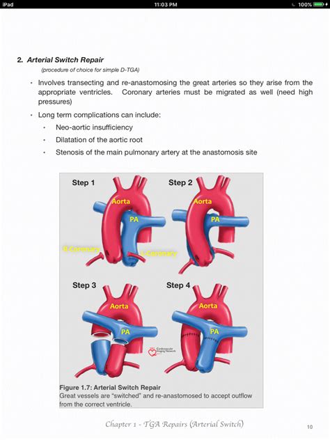 Cardiac Sonography, Congenital Heart, Tga, Stenosis, Med School ...