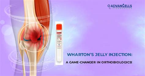 Wharton’s Jelly Injection: A Game-Changer in Orthobiologics ...