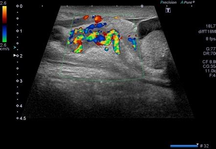 Radiology Quiz 94743 | Radiopaedia.org