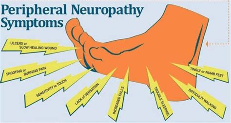 Is There A Solution For Neuropathy? | Sugar Land Health Center