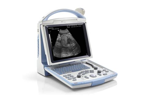 Mindray DP-10 Ultrasound Diagnostic System