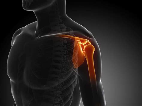 Everything You Need To Know About Shoulder Dislocations | AICA Orthopedics