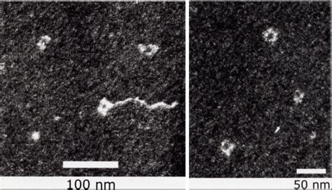 Electron Microscope Dna