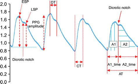 Photoplethysmogram (PPG) signal features. ESP: early systolic peak,... | Download Scientific Diagram