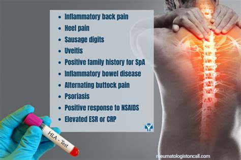 Ankylosing Spondylitis -Is HLA-B27 Essential for Diagnosis?