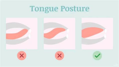 Proper Mewing Tongue Posture: Before and After Adopting Correct Resting ...