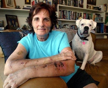 Dog-attack victim fought back – Chico Enterprise-Record