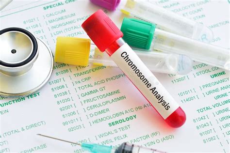 Blood for chromosome test stock photo. Image of health - 107569922