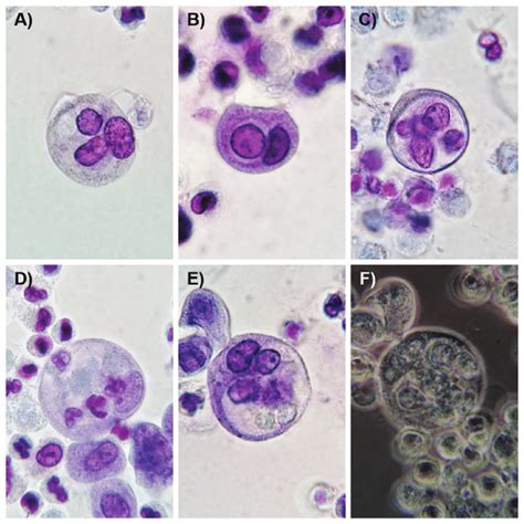 Observation of urothelial cells and leukocytes inside urothelial cell... | Download Scientific ...