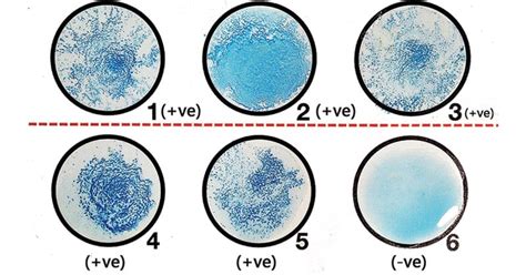 Latex Agglutination Test