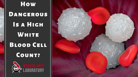 How Dangerous Is a High White Blood Cell Count?