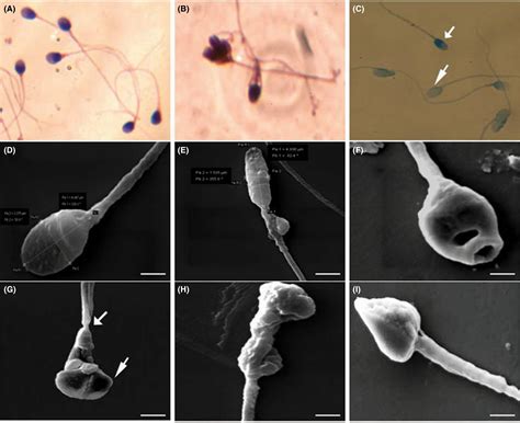 Human Sperm Under Microscope