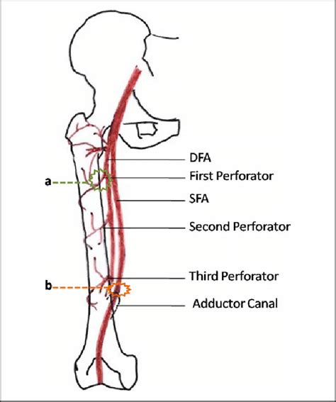 Vascular anatomy and sites of injury. (a) Green wireframe shows the... | Download Scientific Diagram