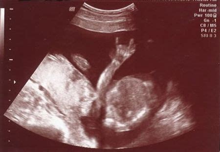 Funny Baby Ultrasound Pictures