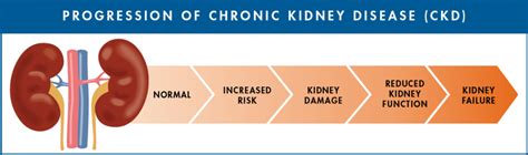 CHRONIC KIDNEY DISEASE – Caritas Medical Center