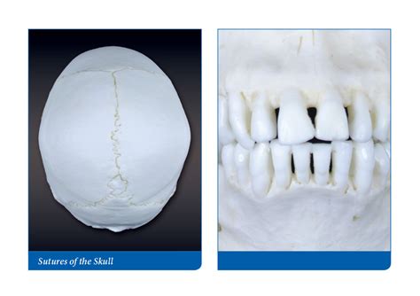 Sutures of the skull and gomphosis Diagram | Quizlet