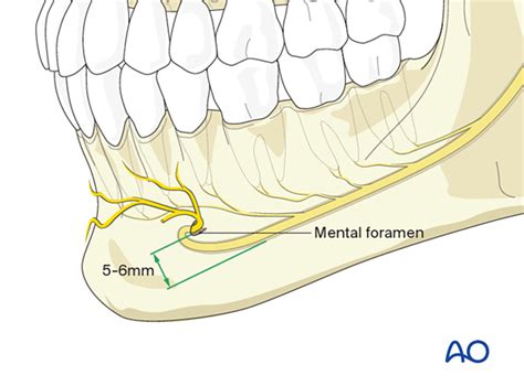 Mental Nerve Damage