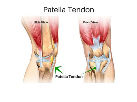 Patellar Tendon Tears – Howard J. Luks, MD