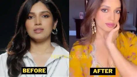 Bhumi Pednekar Plastic Surgery Details. Before After Photos.