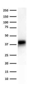 Anti-EpCAM antibody [EGP40/1372] KO Tested (ab218448) | Abcam