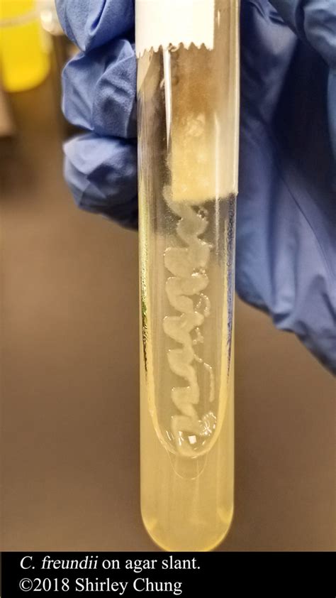 Microbiology: Slant tube. – Basic Sciences