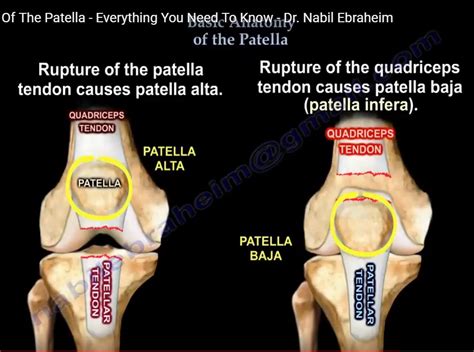 Anatomy and Biomechanics of the Patella — OrthopaedicPrinciples.com